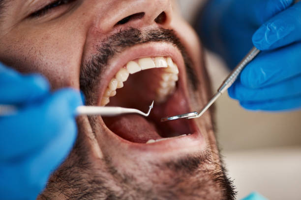 Best Urgent Tooth Repair  in Stock Island, FL